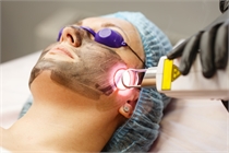 The Hollywood Laser Peel image