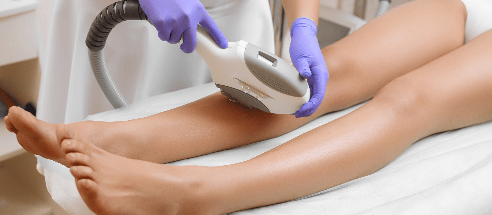 laser treatment on legs