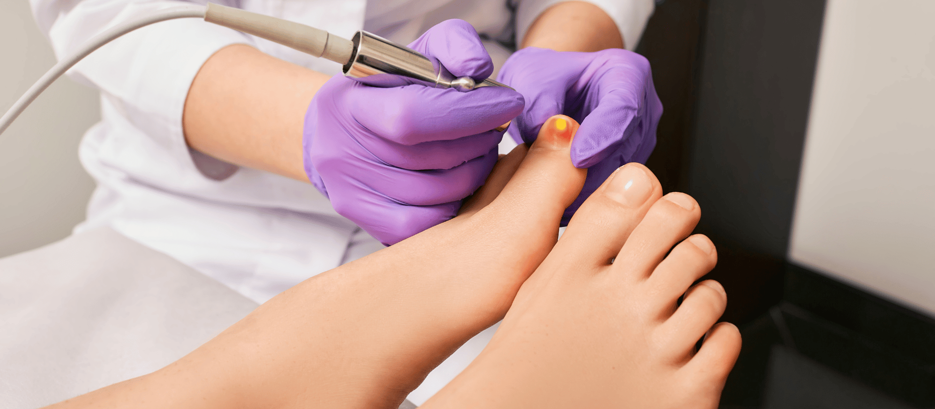 doctor performing laser procedure on toes