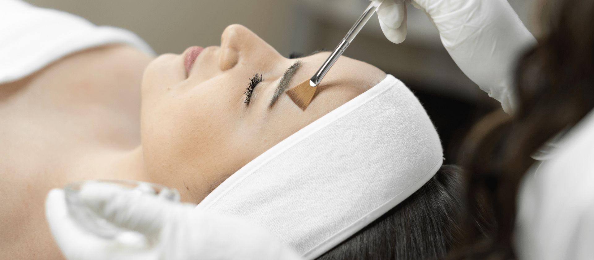 chemical peel treatment