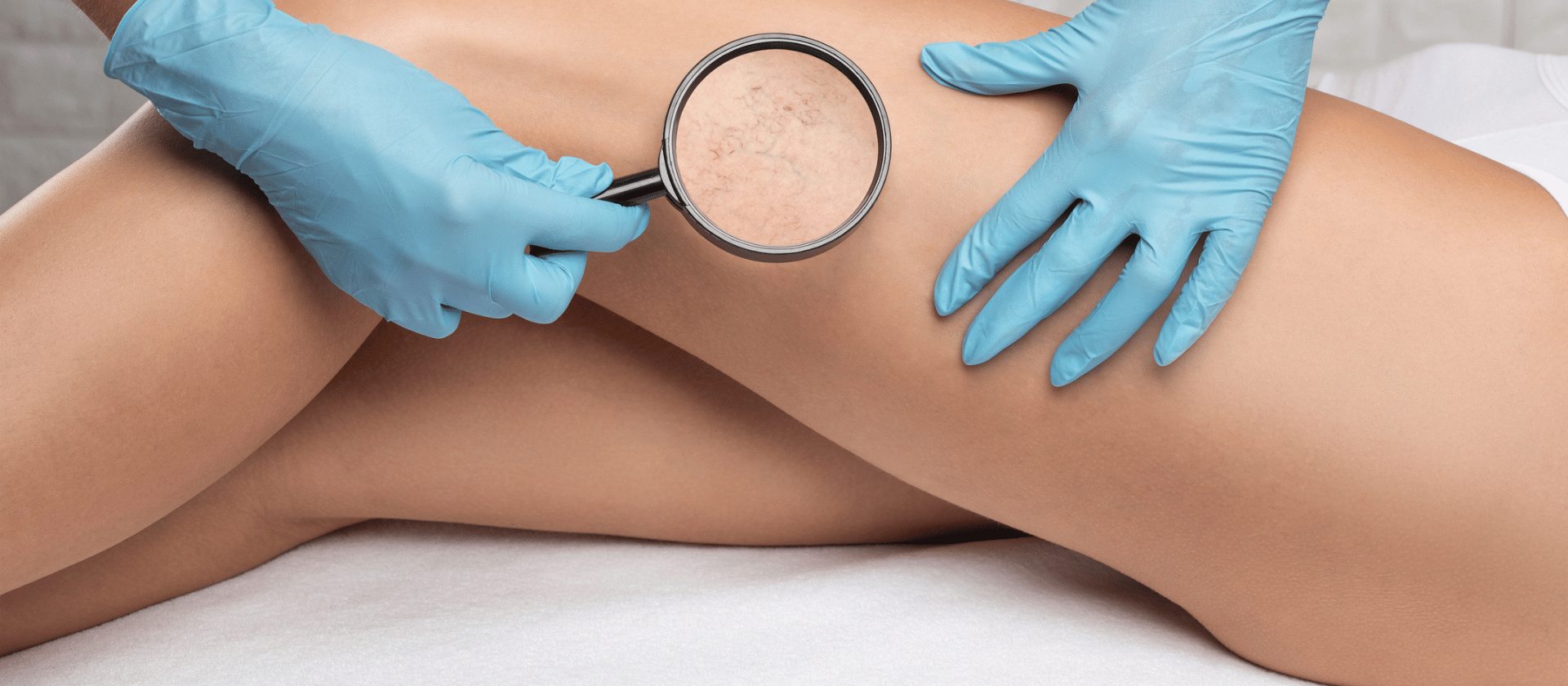 looking at blood vessels on someone's legs