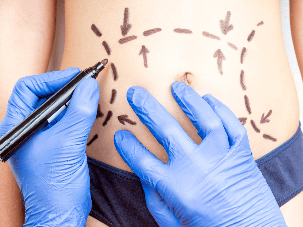 getting rid of stomach fat