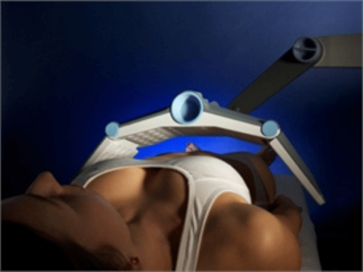 vanquish procedure